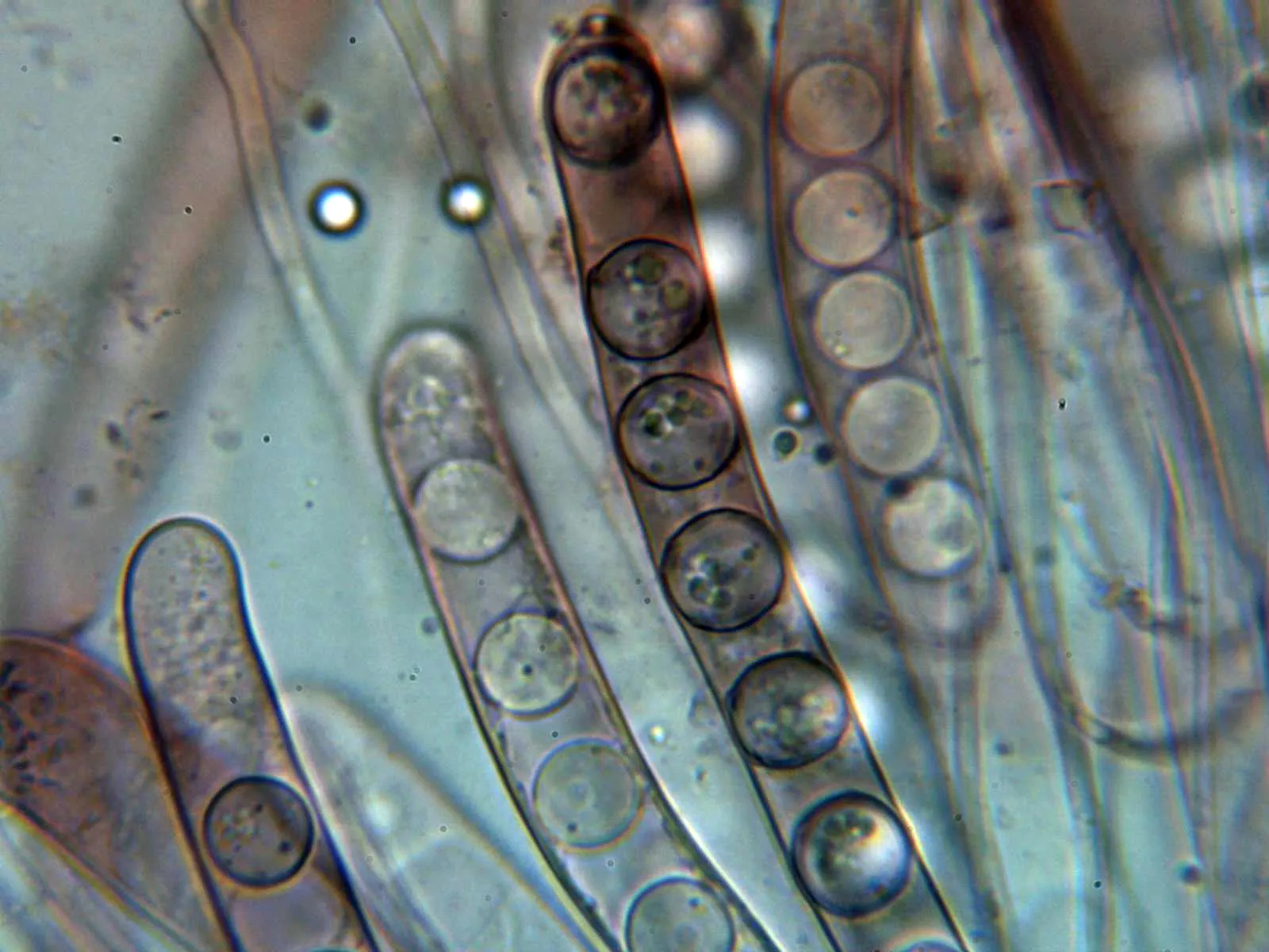Microscopía de Smardaea planchonis - 10 - Ascas 1